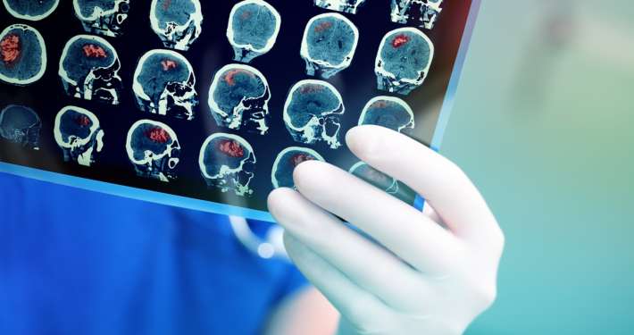 Doctor attentively examines the MRI scan of the patient.