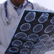 Doctor Examining Mri Images Of Patient With Multiple Sclerosis I