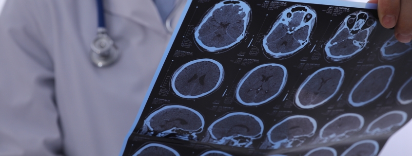 Doctor Examining Mri Images Of Patient With Multiple Sclerosis I