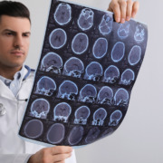 Gamma Knife surgery - Doctor examining MRI images