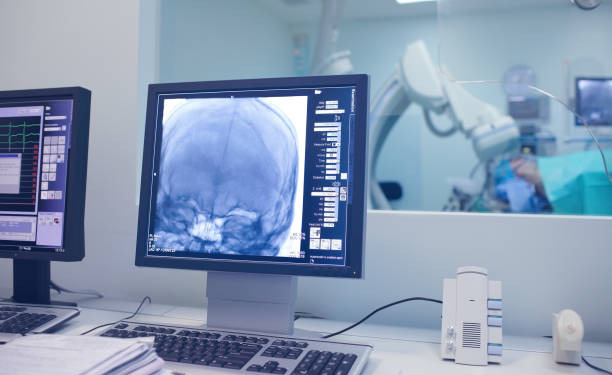 Gamma knife surgery - X-ray examination