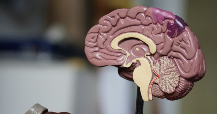 meningioma treatment - brain model