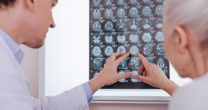 brain tumour treatment - woman looking at the brain X ray image