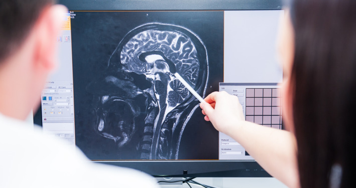 gamma knife surgery - Doctors consider and discuss magnetic resonance image