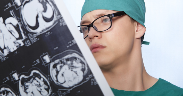 Gamma Knife radiosurgery - doctor examines X-ray picture of a human brain